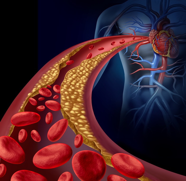 cardiac calcium cardiac calcium