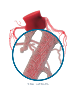 HeartFlow-3DPhysiologicAssessment-Web-1