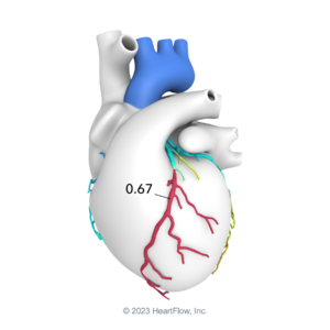 HeartFlow-StylizedHeart-NoBkgr-Web-1